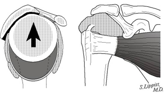 Home Exercises for the Unstable Shoulder  UW Orthopaedics and Sports  Medicine, Seattle