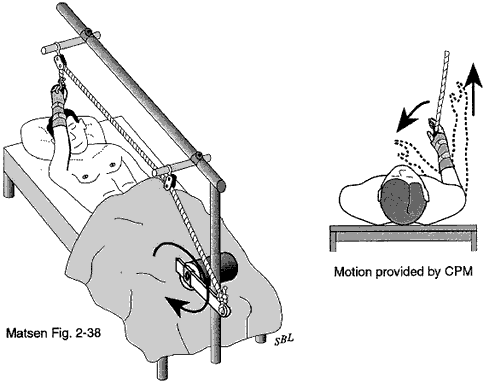 Figure 1 - Continuous passive motion machine