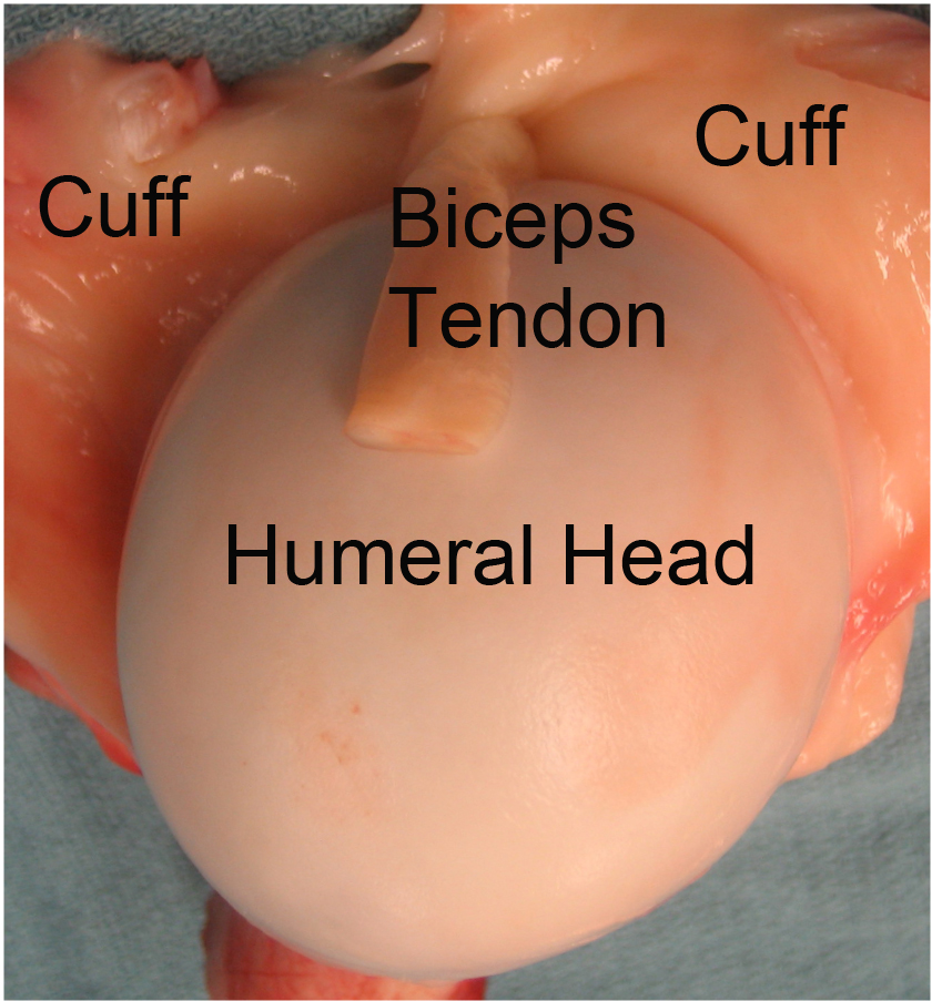 Torn rotator deals cuff surgery