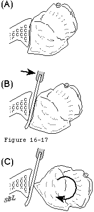 Figure 33