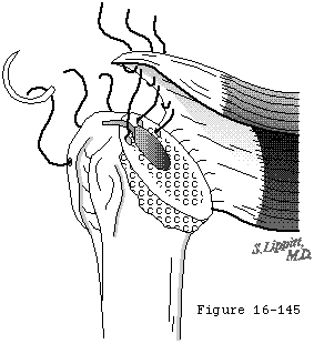 Figure 37