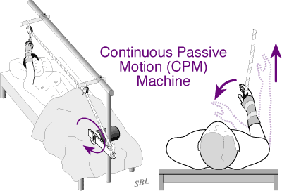 Rotator Cuff Continuous Passive Motion Machine