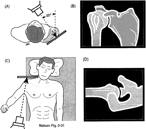 Figure 5: X-ray views used to diagnose arthritis