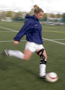 Active After Acl Surgery Uw Orthopaedics And Sports Medicine Seattle