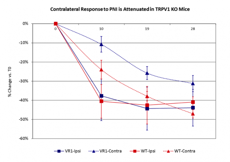 Contralateral Response to Peripheral Nerve Injury