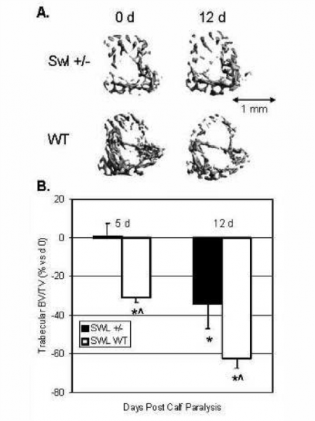 Neuromuscular Proprioception and Bone Homeostasis