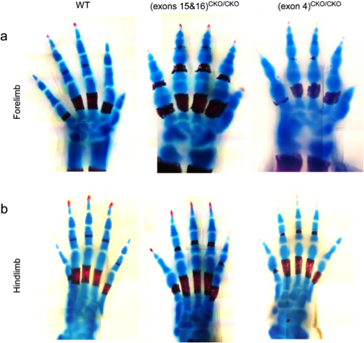 Regulation of Interphalangeal Joint Development