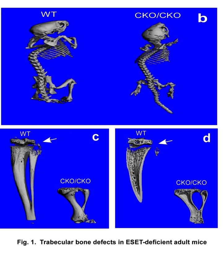 Development of trabecular bones